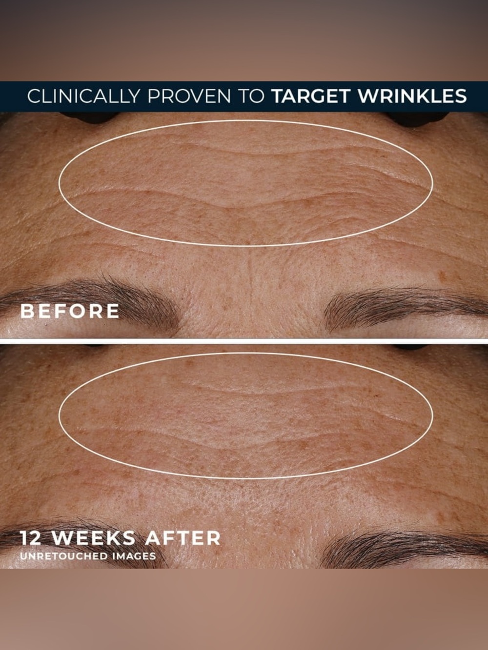 RoC Retinol Correxion Duo: Deep Wrinkle Night & Line Smoothing Eye Cream Set - Picture 9 of 16